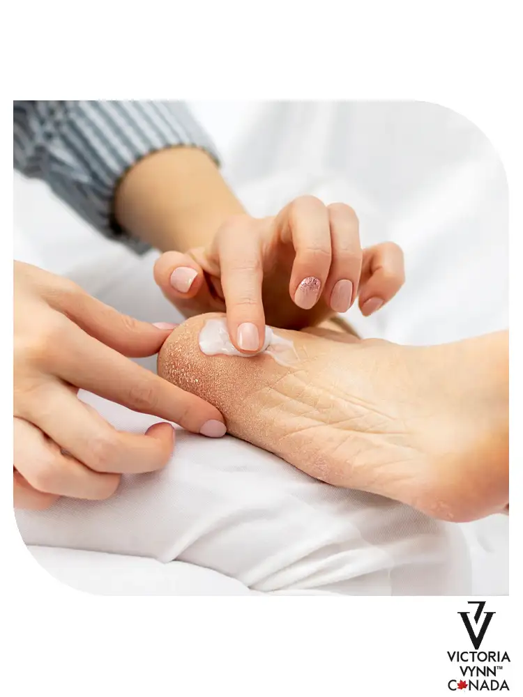 Pharm Foot : la meilleure crème hydratante pour les mains et le corps destinée aux peaux sèches – Huile à l'ozone O3 Concentré au beurre