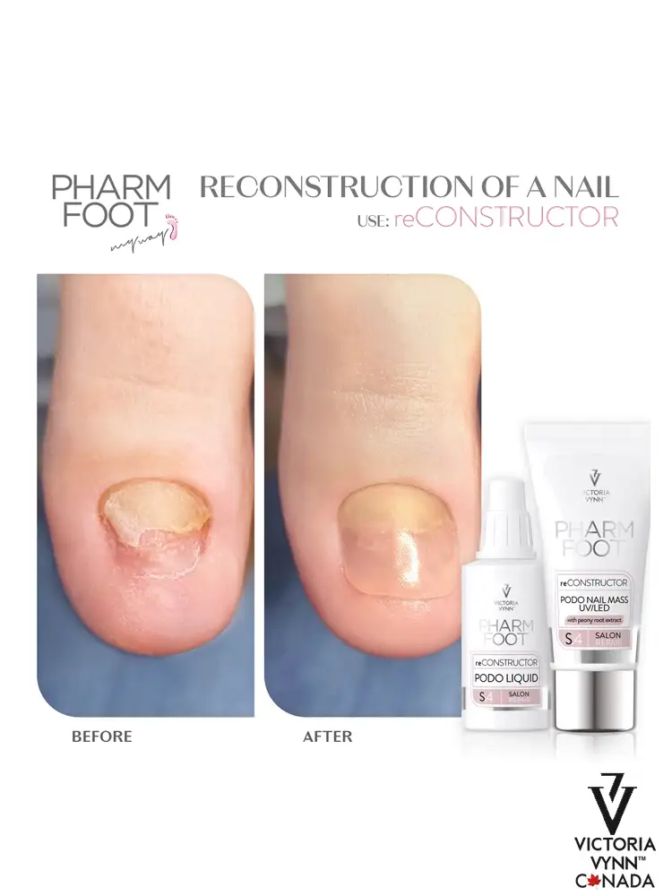 Kit de pédicure et de reconstruction des orteils Pharm Foot « reCONSTRUCTOR » 30 ml