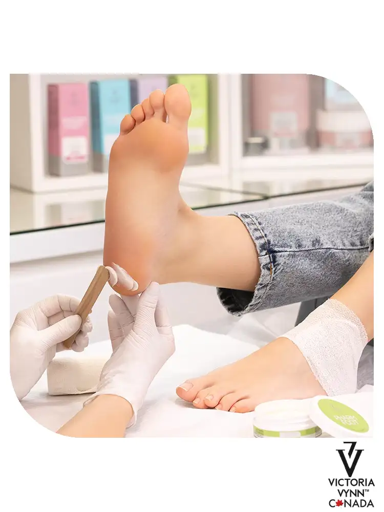 Pharm Foot : la meilleure pommade pour soigner les talons fissurés, protecteur pour talons fissurés, 200 ml